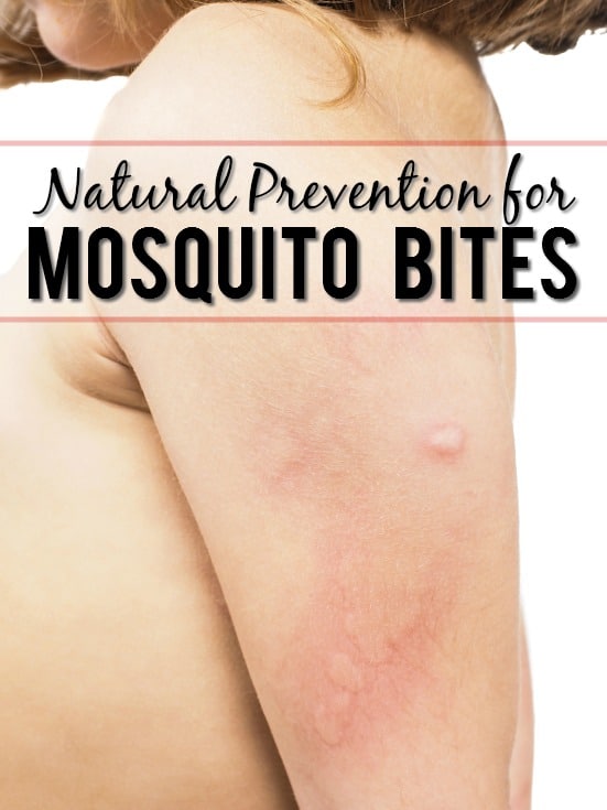 Natural Prevention for Mosquito Bites - Have more mosquito-free fun outside this Summer with these 5 simple and natural ways to prevent mosquito bites that are also totally safe for kids and pets. Parenting Tips | DIY